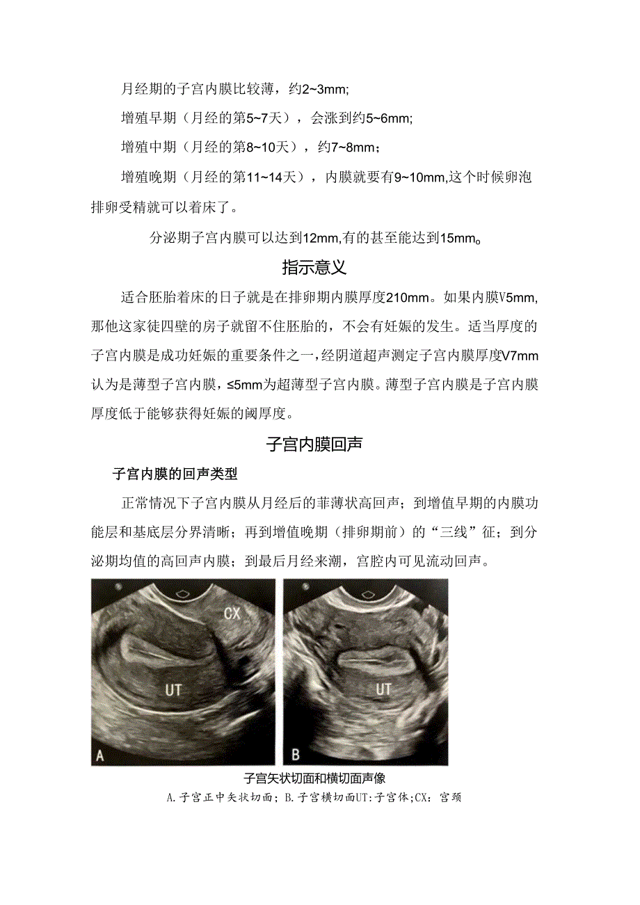 临床子宫内膜厚度、子宫内膜回声、子宫动脉和内膜下血流参数等超声评估子宫内膜受容性要点.docx_第2页