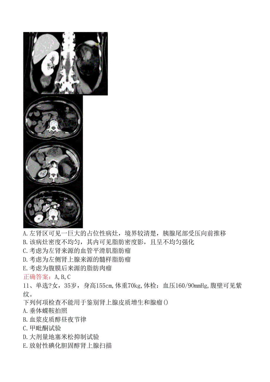 内分泌学(医学高级)：肾上腺疾病考试答案（题库版）.docx_第3页