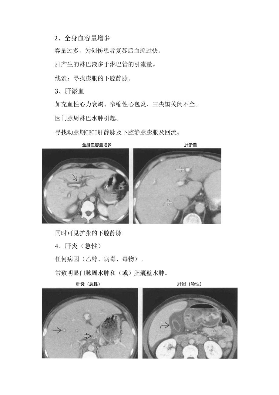 临床肝门静脉周透亮或水肿（门静脉周围间隙增宽）鉴别诊断、鉴别诊断要点、常见诊断有用线索及不常见诊断有用线索.docx_第3页