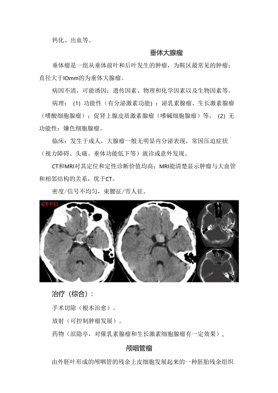 临床垂体大腺瘤、颅咽管瘤、脑膜瘤、动脉瘤等疾病病理、临床表现、治疗方式及影像鉴别要点和影像学表现.docx_第2页