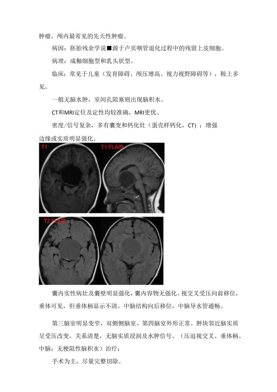 临床垂体大腺瘤、颅咽管瘤、脑膜瘤、动脉瘤等疾病病理、临床表现、治疗方式及影像鉴别要点和影像学表现.docx_第3页