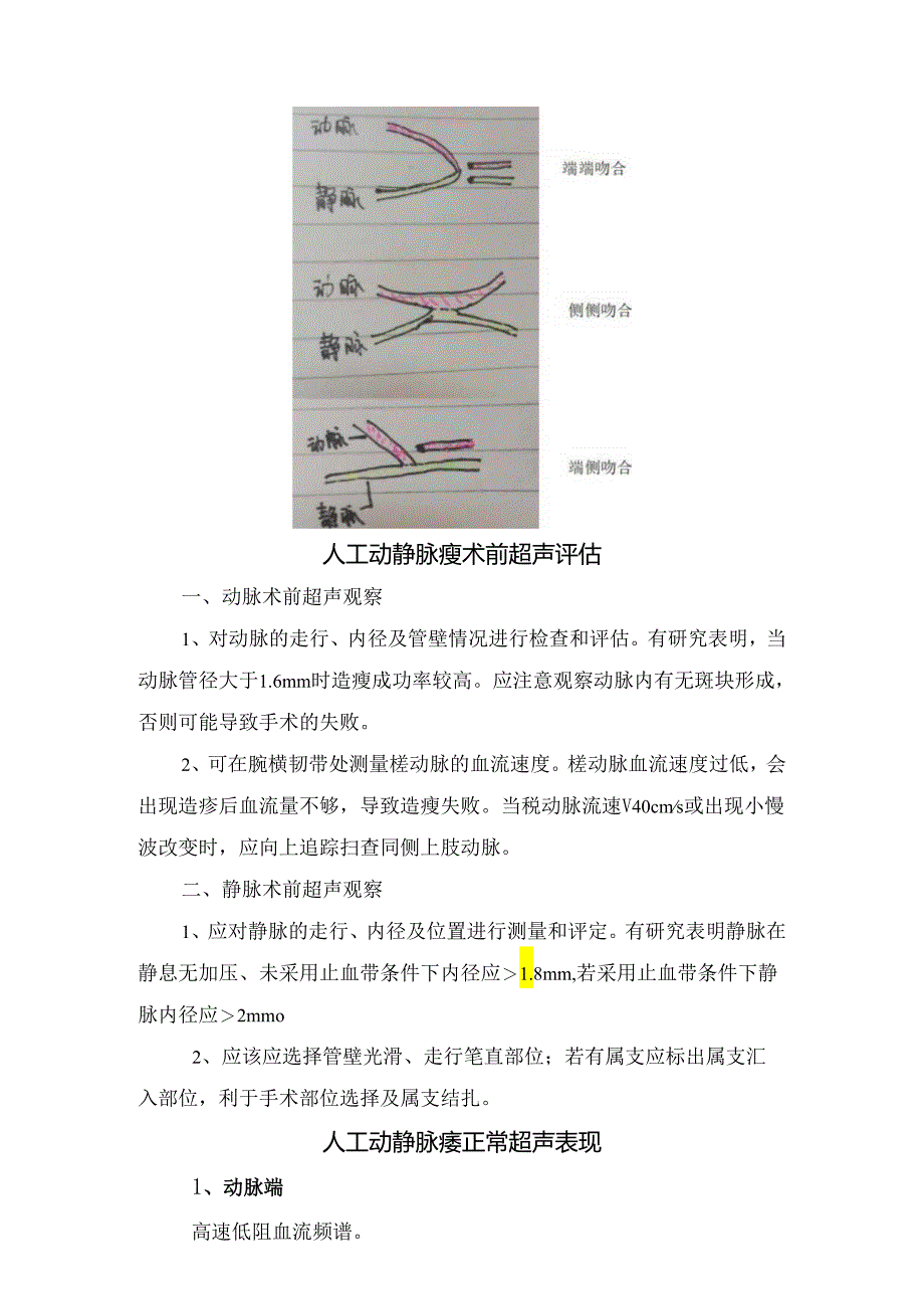 临床人工动静脉瘘方式、术前超声评估、正常超声表现及术后并发症超声监测.docx_第2页