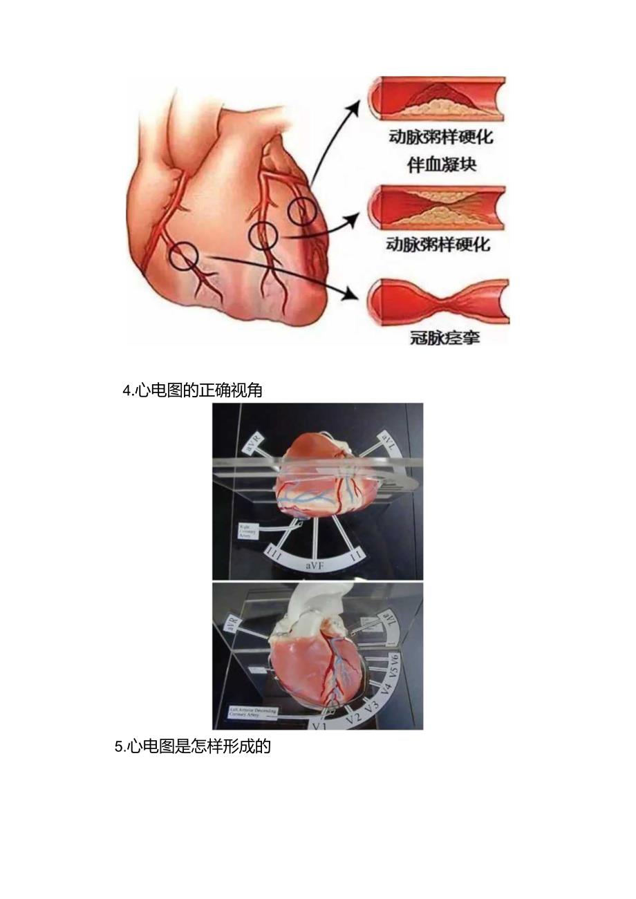 心脏传导系统、冠心病、心电图、抗心律失常药、高血压联合用药等心血管疾病原理.docx_第2页