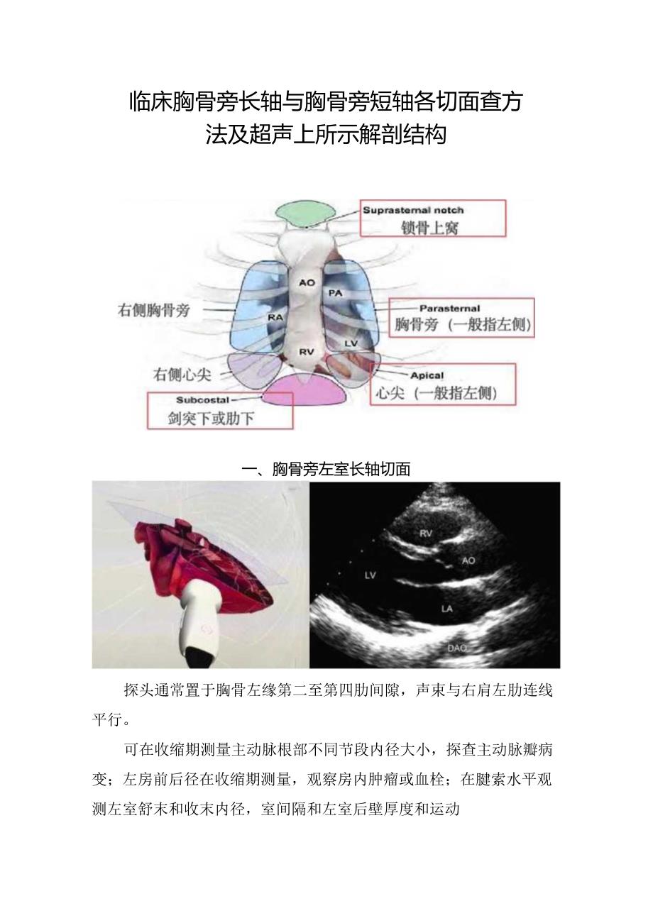 临床胸骨旁长轴与胸骨旁短轴各切面查方法及超声上所示解剖结构.docx_第1页