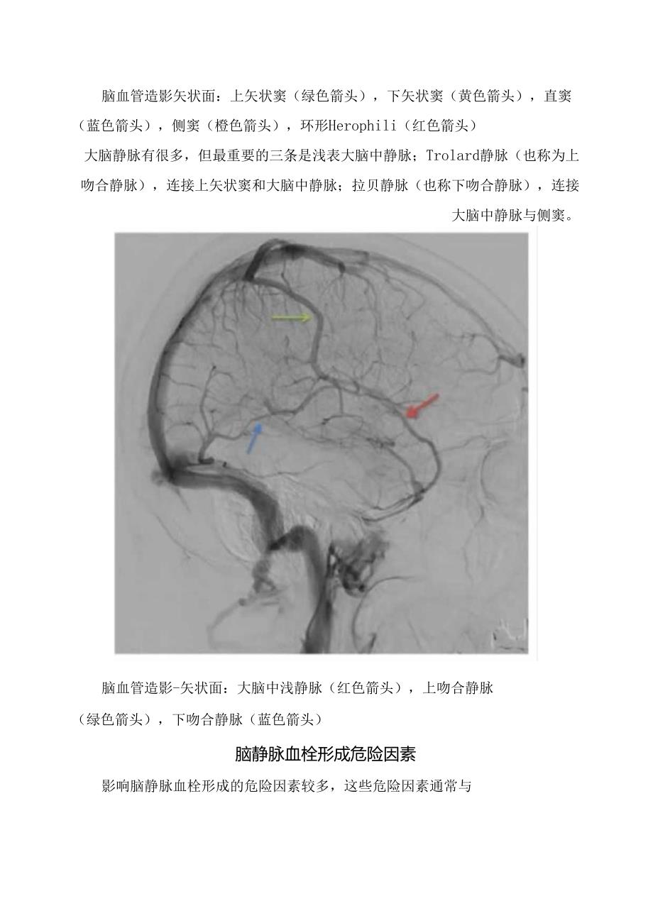 临床颅内静脉系统结构、脑静脉血栓形成危险因素、诊断及治疗要点.docx_第2页