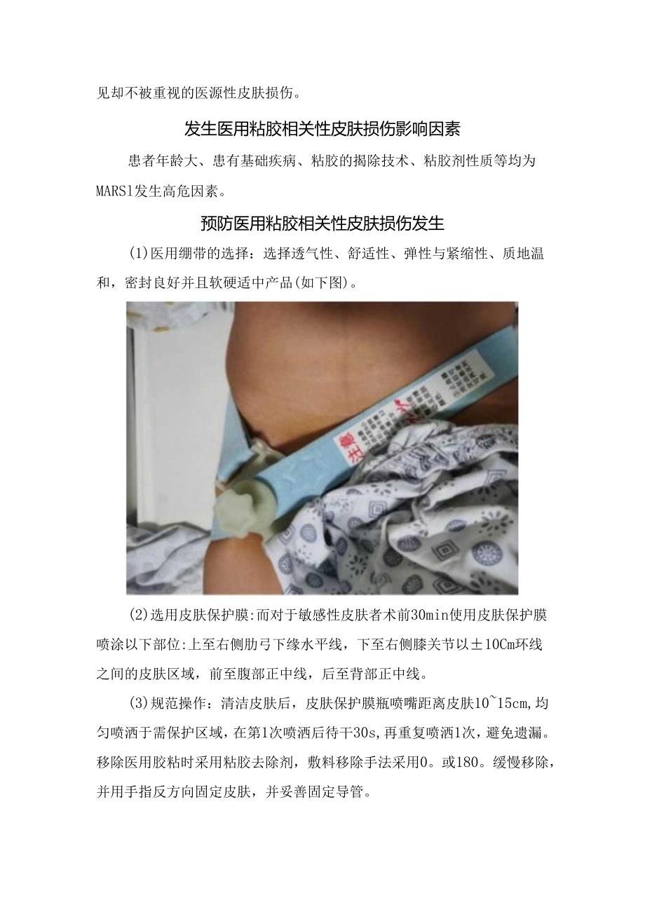 临床DSA脑血管造影术后皮肤医用粘胶相关损伤影响因素、预防发生、发生张力性水泡护理及健康教育.docx_第2页