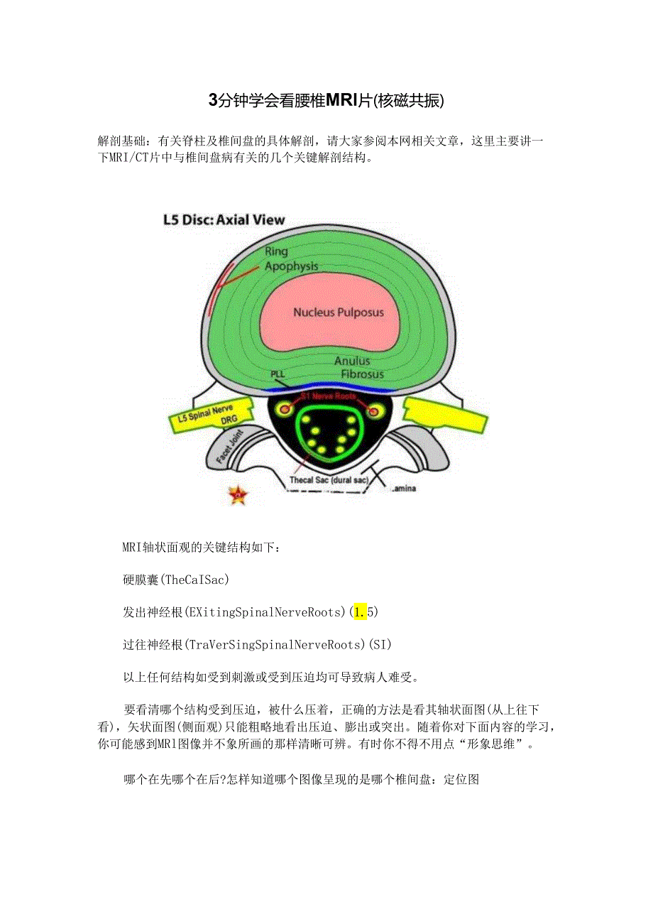 3分钟学会看腰椎MRI片.docx_第1页