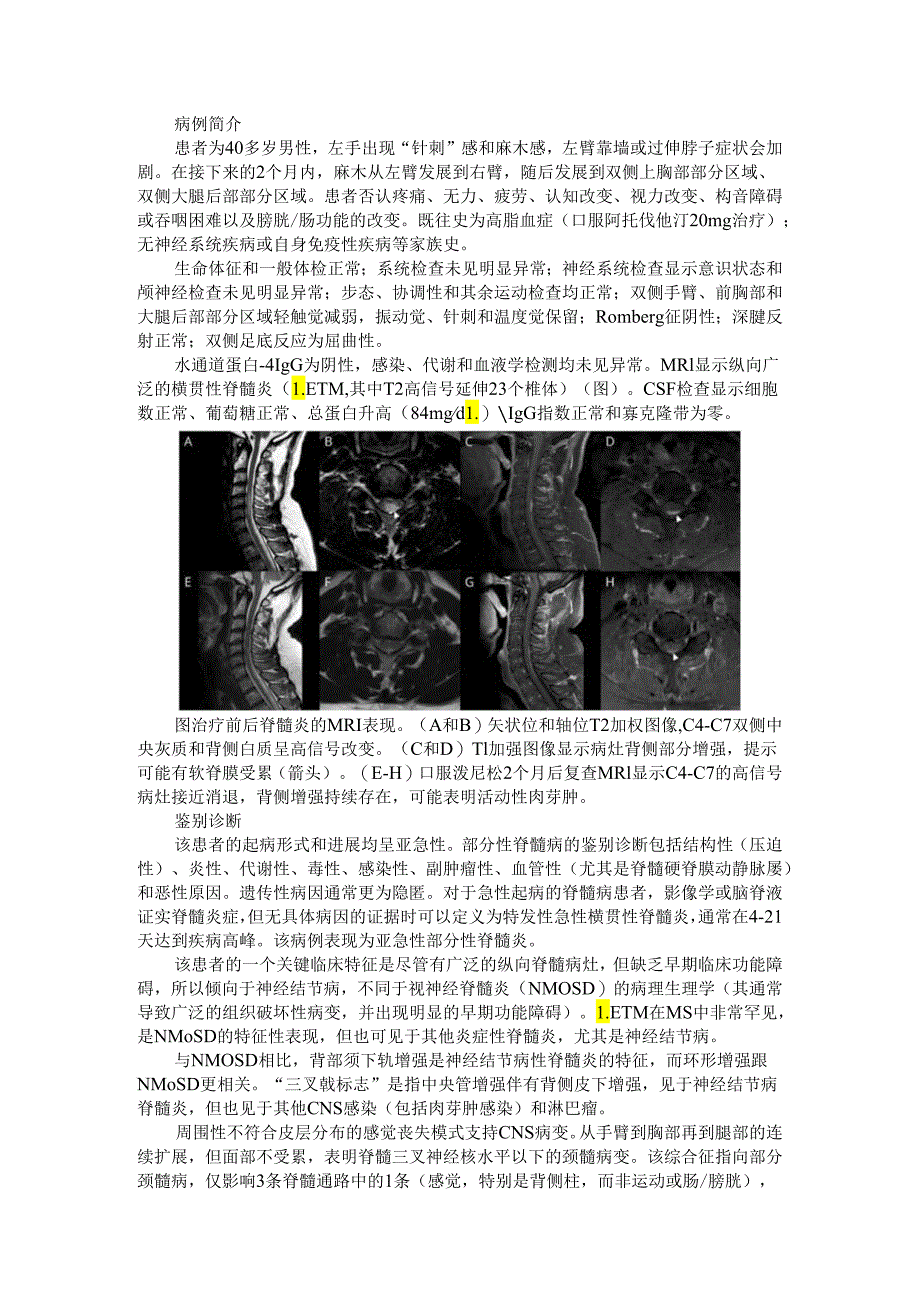 CNS神经结节病（脊髓神经结节病）治疗 病例探究.docx_第1页