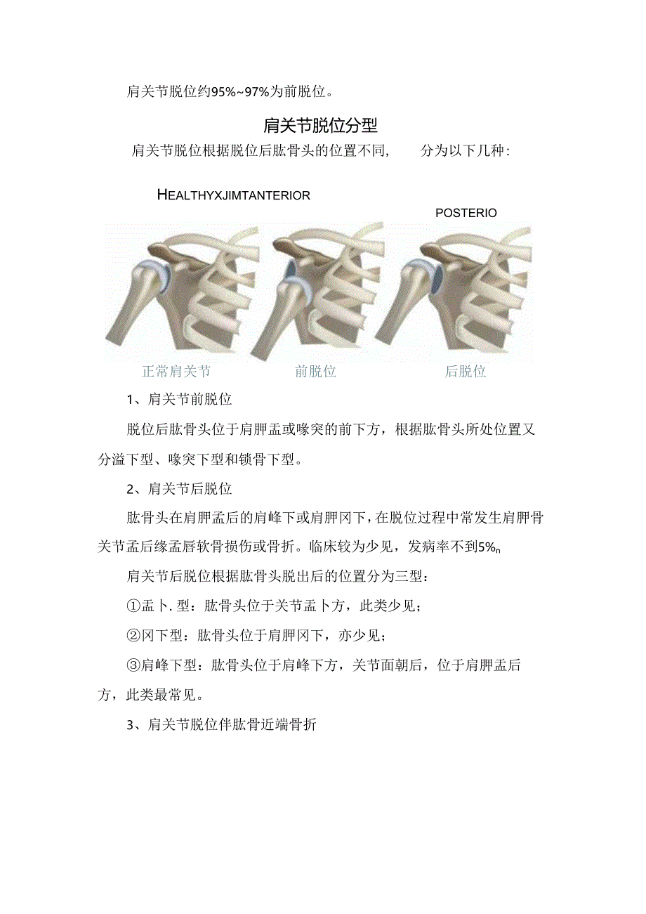 临床肩关节解剖、肩关节前脱位分型、诊断、复位方法、康复及总结.docx_第1页