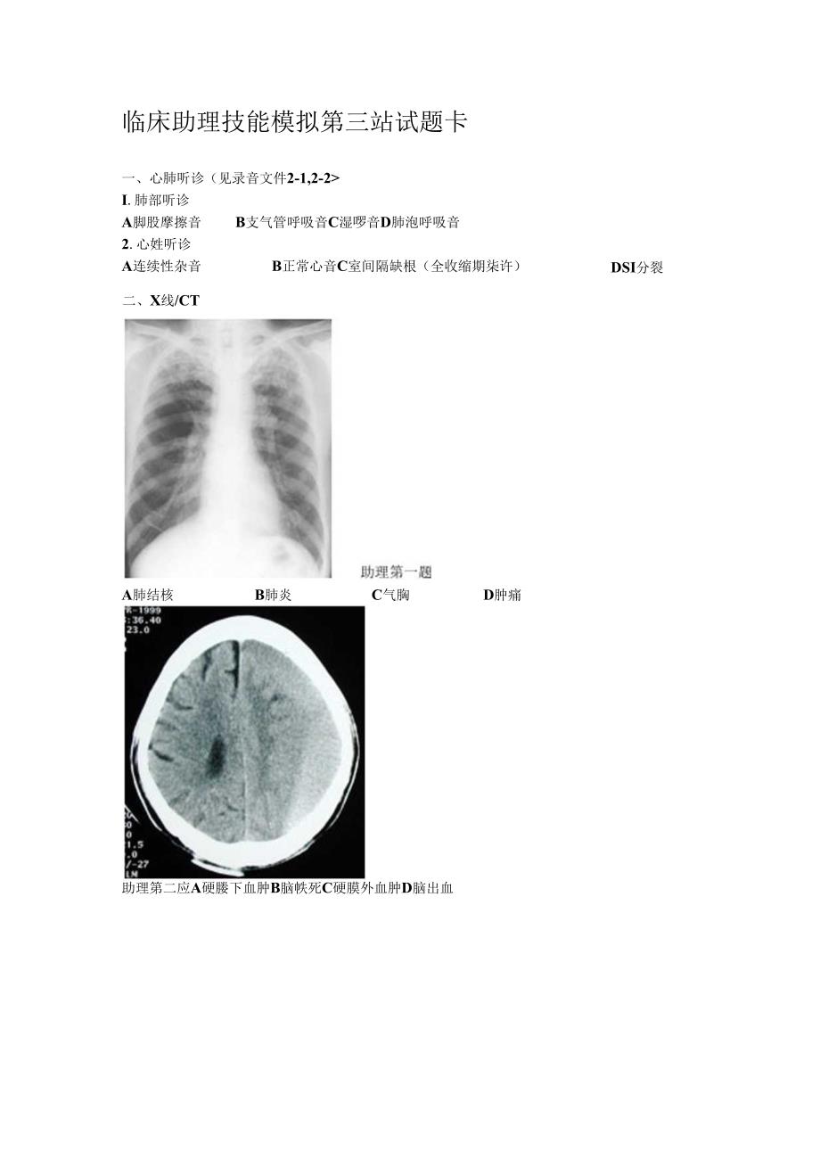 临床助理第三站 技能模拟第二套试题卡.docx_第1页