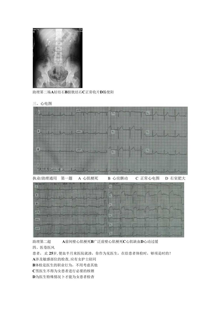 临床助理第三站 技能模拟第二套试题卡.docx_第2页