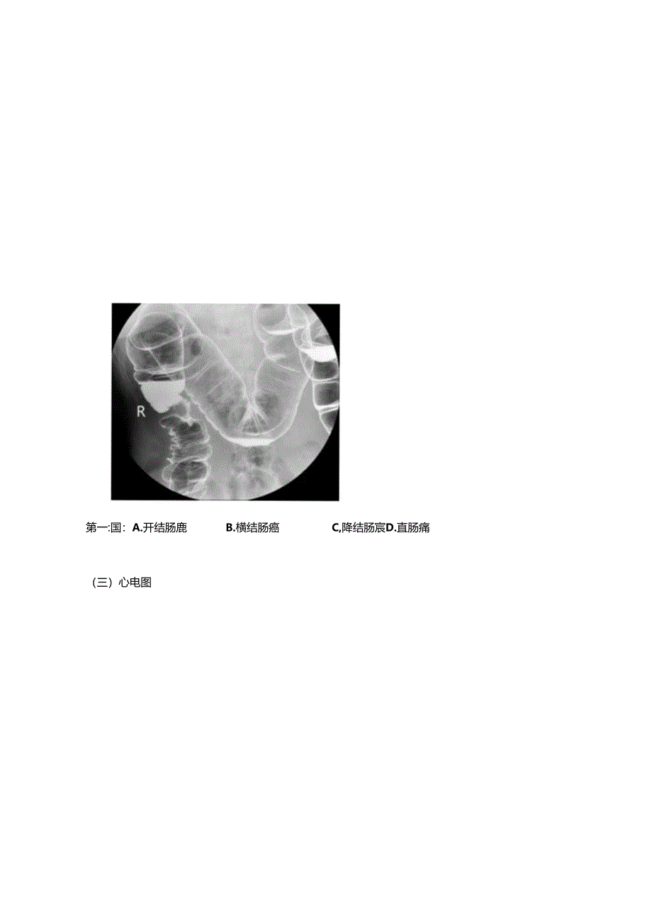 临床执业第三站 技能模拟第一套试题.docx_第3页