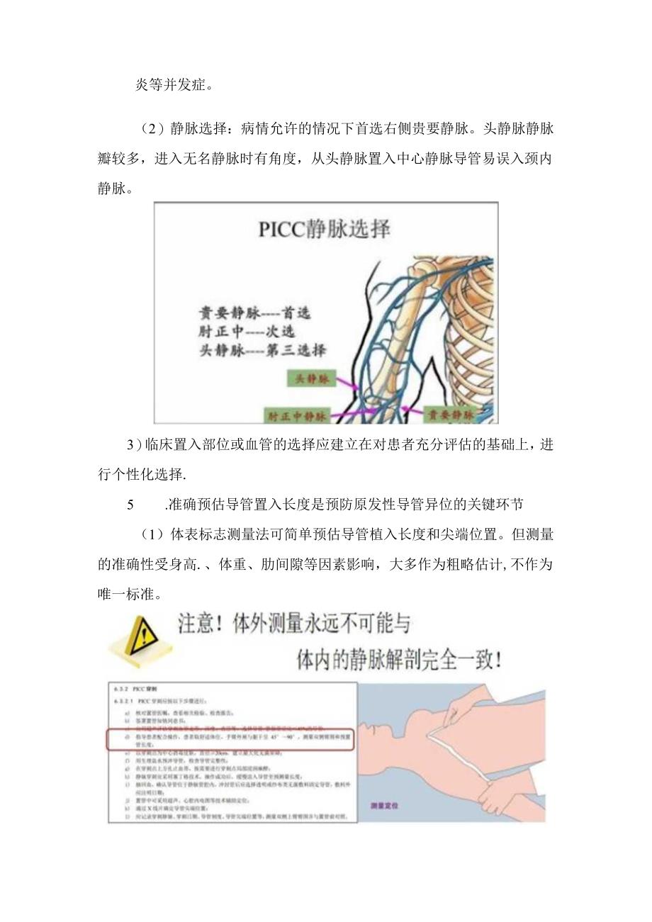 临床成人PICC上臂输液港原发性导管异位管理要点.docx_第3页