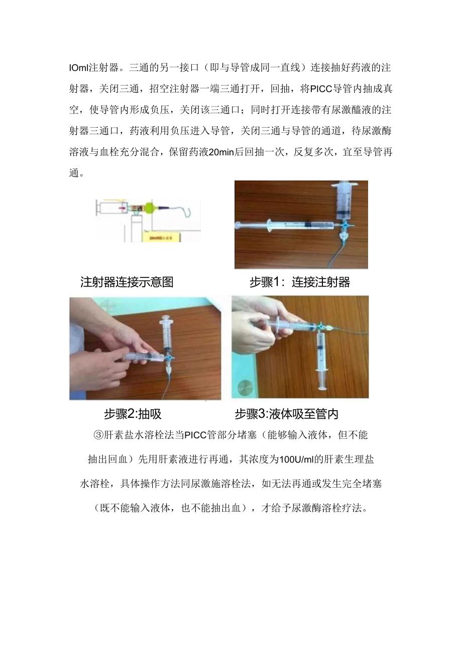 临床PICC血栓性堵管用尿激酶溶栓要点.docx_第3页