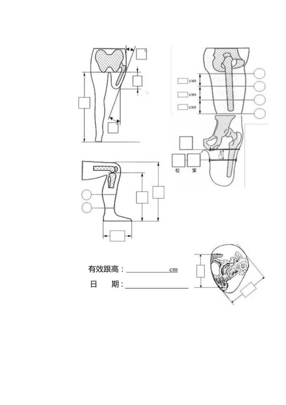 大腿假肢接受腔测量尺寸表.docx_第2页