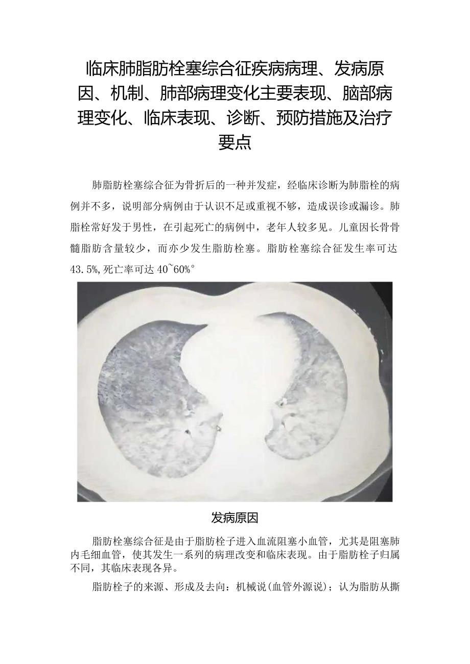 临床肺脂肪栓塞综合征疾病病理、发病原因、机制、肺部病理变化主要表现、脑部病理变化、临床表现、诊断、预防措施及治疗要点.docx_第1页