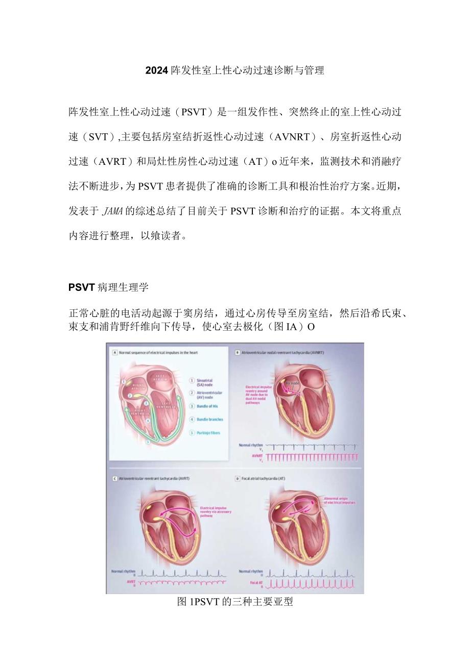 2024阵发性室上性心动过速诊断与管理.docx_第1页