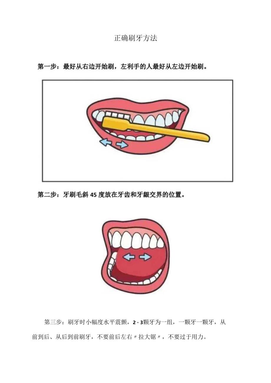 XX卫生健康职业学院牙齿预防与保健措施（2024年）.docx_第3页