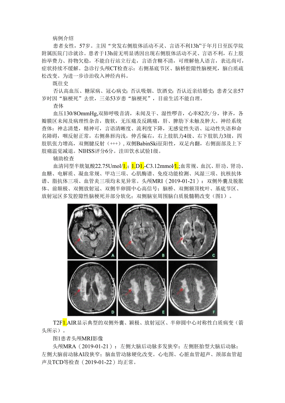 伴皮质下梗死和白质脑病的常染色体显性遗传性脑动脉病3例.docx_第1页