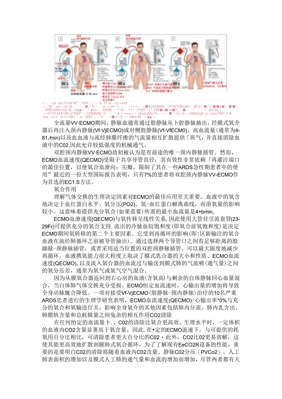 成人急性呼吸窘迫综合征（ARDS）的体外生命支持.docx_第2页