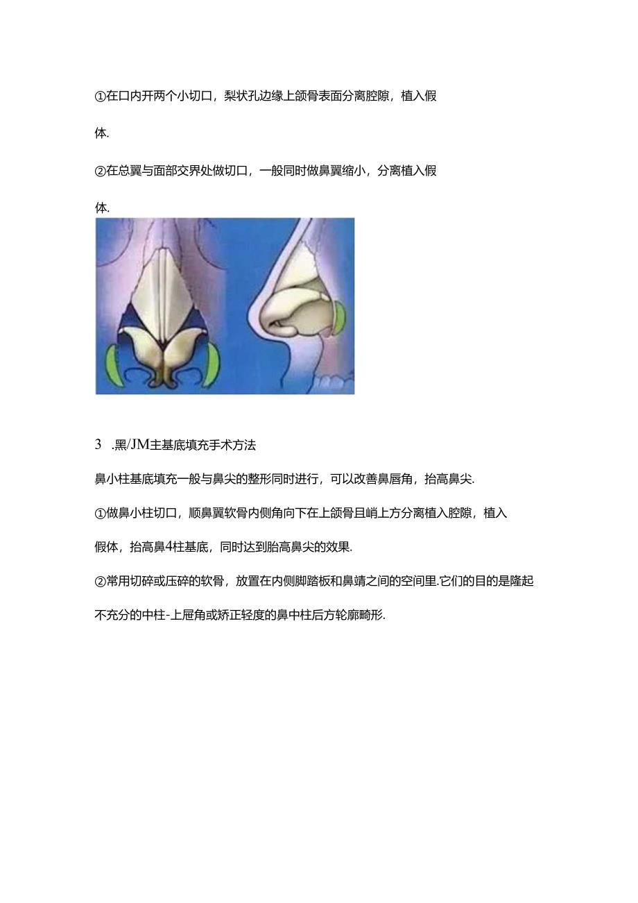 医美鼻整形鼻基底术式分解.docx_第2页