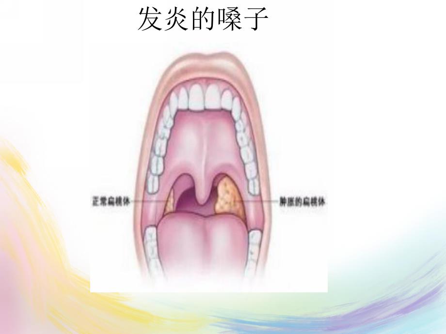 小班安全《保护嗓子》PPT课件教案保护嗓子.pptx_第3页