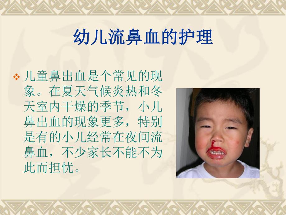 幼儿园常见病护理PPT课件幼儿园常见病护理PPT课件.ppt_第2页