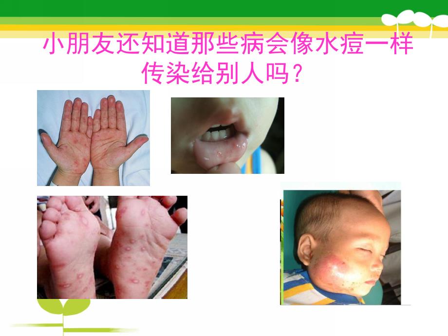 小班健康《好朋友生病了》PPT课件教案幼儿园小班-好朋友生病了.ppt_第3页